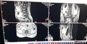 Поддержка от спонсоров из Москвы - Снимок МРТ 2018.jpeg