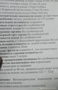 Как мне выжить,что делать я незнаю. - IMG_20230428_141920.jpg