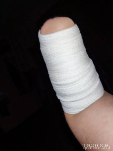 Сбор на протез руки - IMG_20230515_002546.jpg