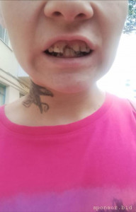 Помогите пожалуйста на новую улыбку - upload_2023_08_16_20_34_47_316.jpg