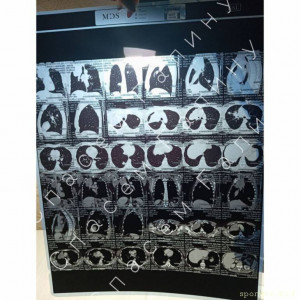 Онкология лёгких 4 ст.Помогите продлить маме жизнь 128591; 127995; - IMG_20240301_154136_786.jpg