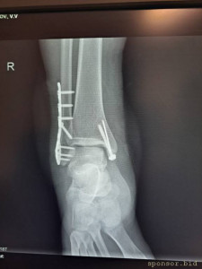 Тяжелая жизненная ситуация - 90575125-2dcc-4fd7-a2cc-f2b5a9c9cac9.jpeg