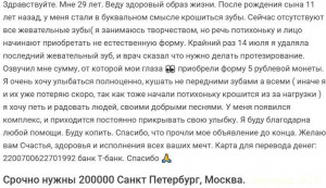 Протезирование Зубов - Без имени-1.jpg