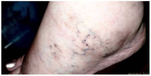 Нужно срочно к флебологу - img_20260214_215216.jpg