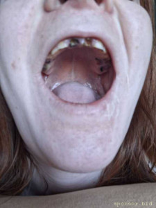 Лечение зубов - 20260417_181244.jpg